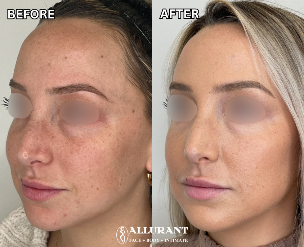 OPUS PLASMA B&A (kendall heldoorn) (2)