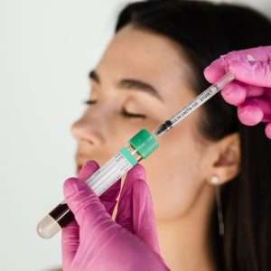 PRF lip enhancement