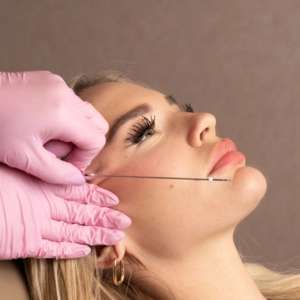 PDO Thread Lift Full Soft Facelift