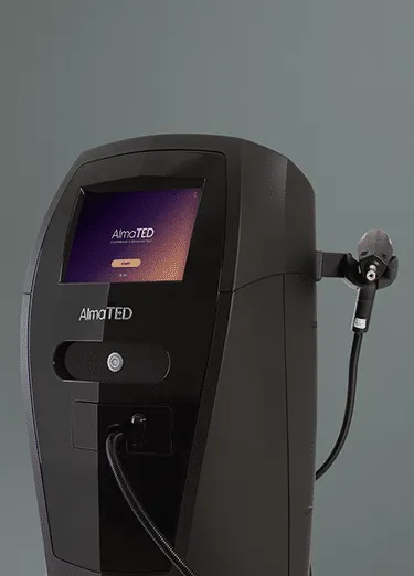 Alma TED ultrasound hair restoration device used for non invasive hair regrowth in San Diego