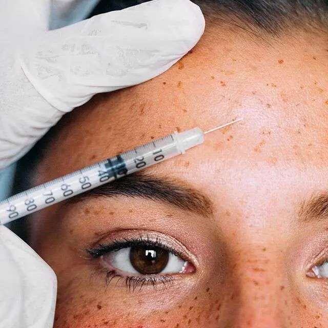 Dysport forehead lines treatment reduce expression lines neurotoxin injection Allurant Medical Spa San Diego