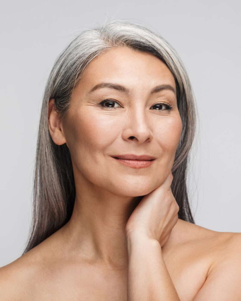Woman showing natural facial aging changes before dermal filler treatment at Allurant Medical Spa in San Diego