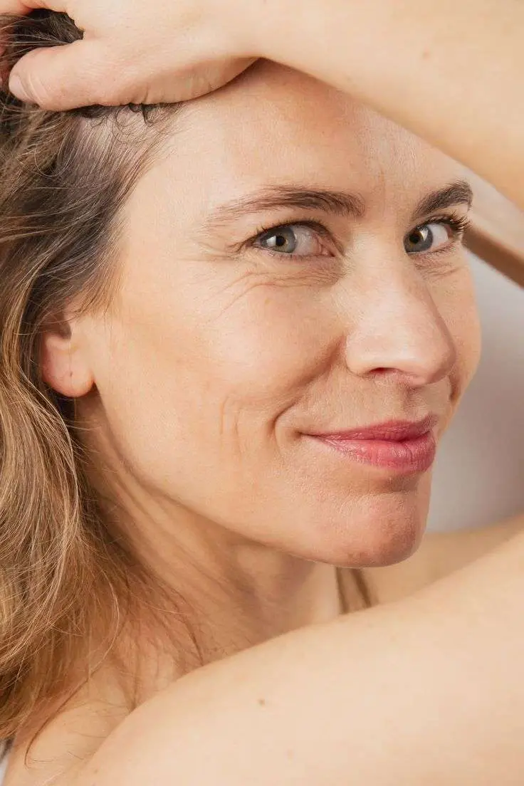 Cheek filler results lifted cheekbones no hollowness balanced facial structure Allurant Medical Spa San Diego