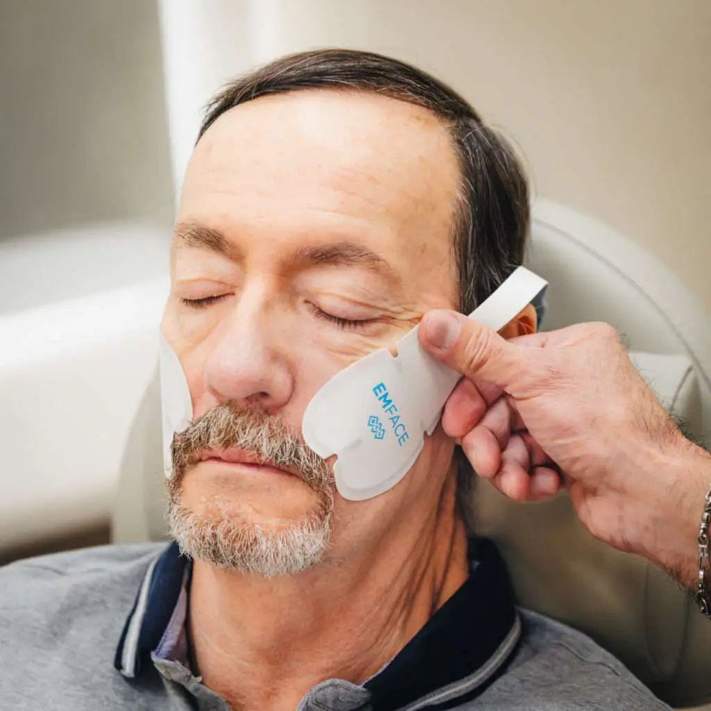Male patient EMFACE cheek lift radiofrequency treatment San Diego Allurant Medical Spa