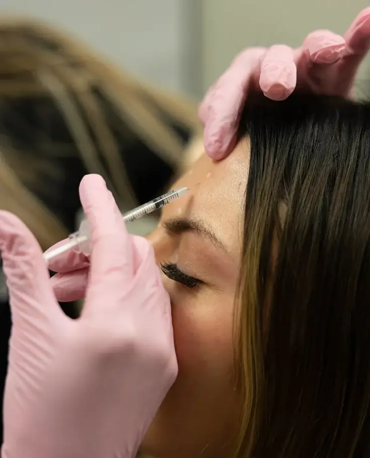 Xeomin forehead lines eleven lines treatment smooth skin natural looking results San Diego