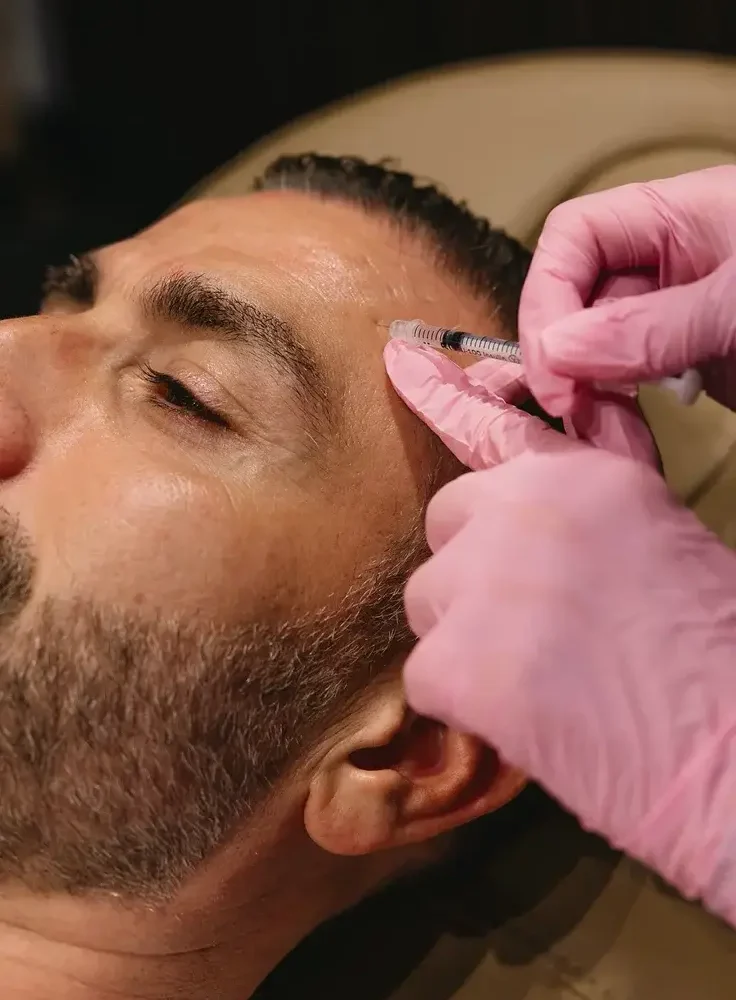 Male patient Dysport crow's feet temple wrinkle reduction fine lines treatment San Diego Allurant Medical Spa