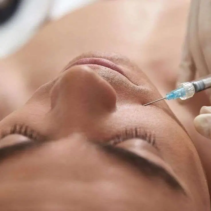 Male patient midface cheek filler hollowness volume restoration facial balancing Allurant Medical Spa San Diego