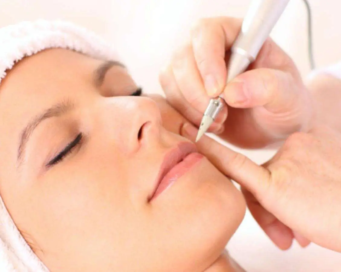 Laser hair removal and electrolysis consultation at Allurant Medical Spa in San Diego