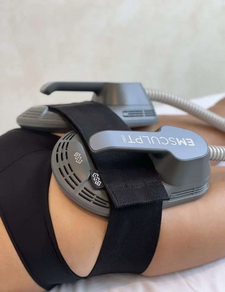 Non surgical butt enhancement with Emsculpt HIFEM muscle stimulation at Allurant Medical Spa San Diego