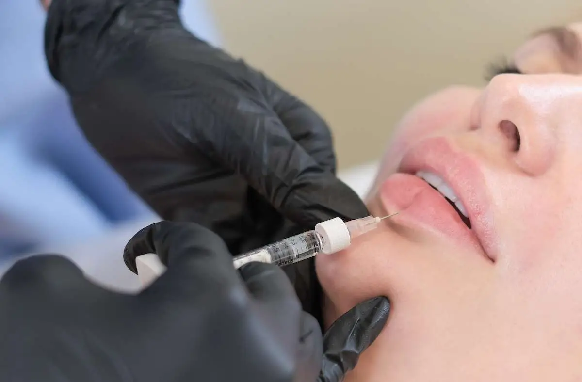 Licensed provider administering Juvederm lip filler injection for volume and definition at Allurant Medical Spa San Diego