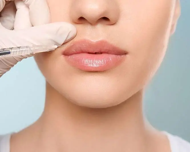 Comparing Botox and dermal filler injection placement on a woman's face to illustrate the difference between muscle relaxation and volume restoration