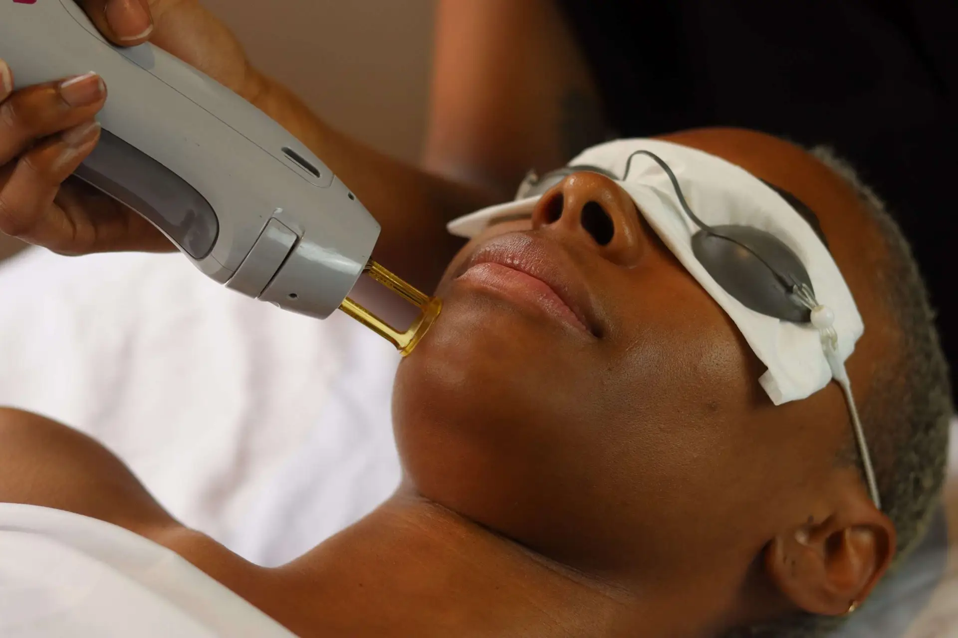Provider using Soprano Ice Platinum laser handpiece on patient with dark skin at Allurant Medical in San Diego