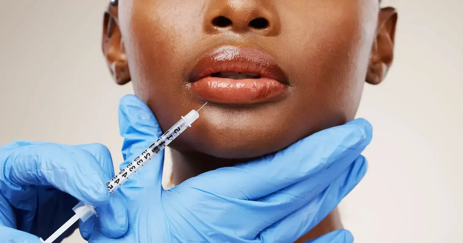Filler dissolution consultation for hyaluronic acid filler removal in San Diego