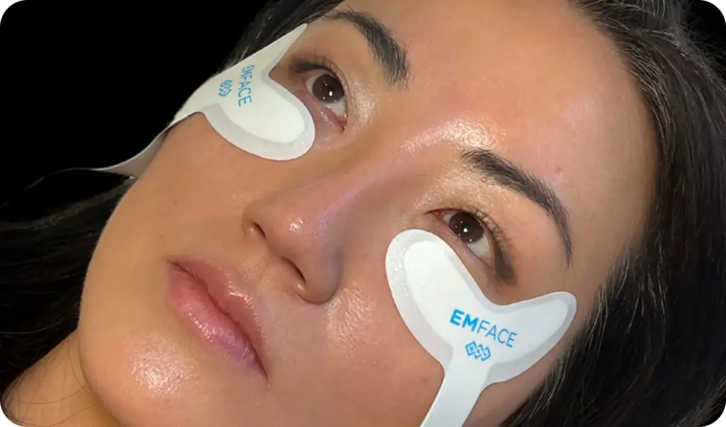 Patient at Allurant Medical in Carmel Valley San Diego receiving EMFACE Eyes treatment for hooded lids and drooping brows