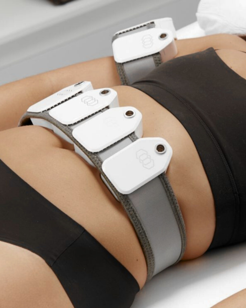 Evolve Tite skin tightening treatment on the abdomen and flanks at Allurant Medical Spa in San Diego
