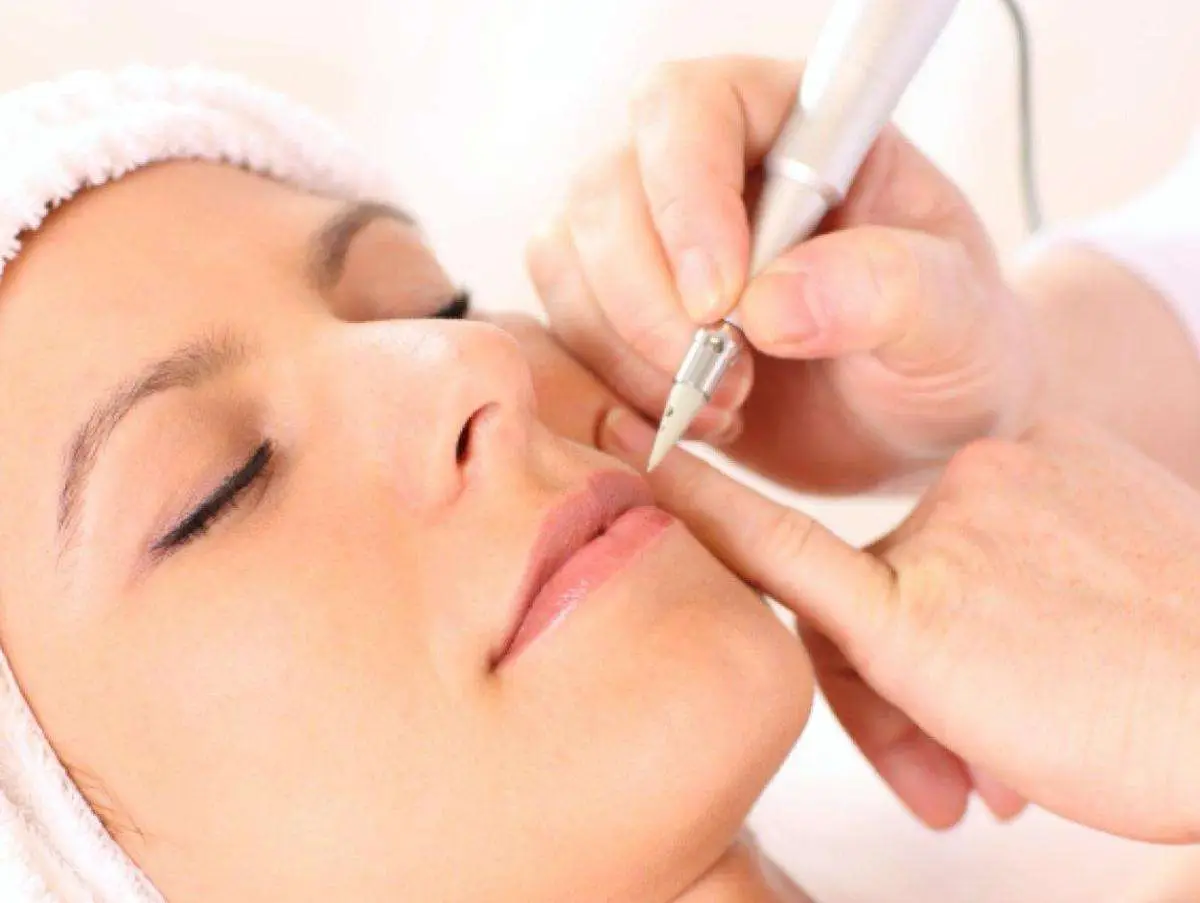 Consultation for permanent hair removal treatments at Allurant Medical Spa