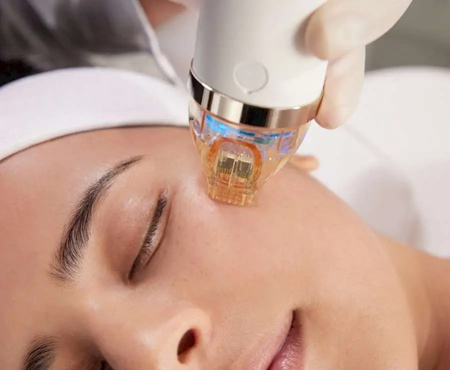 Patient treatment for non-surgical skin tightening face treatment at Allurant Medical in Carmel Valley San Diego