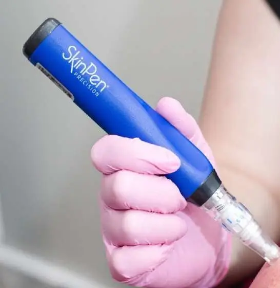 SkinPen microneedling device used for collagen induction therapy at Allurant Medical Spa in San Diego