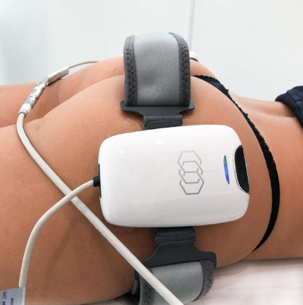 Non surgical glute toning with Evolve Tone muscle stimulation at Allurant Medical Spa in San Diego