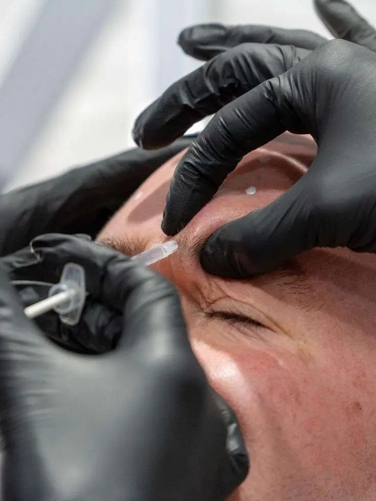 Jeuveau eleven lines injection brow wrinkle treatment neurotoxin San Diego Allurant Medical Spa