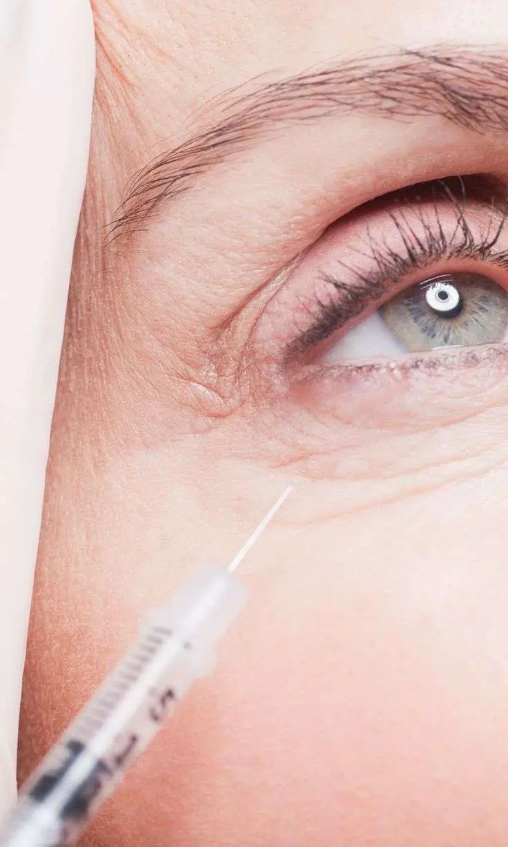 PRF under eye fine lines wrinkles aging under eye platelet rich fibrin injection Allurant Medical Spa San Diego
