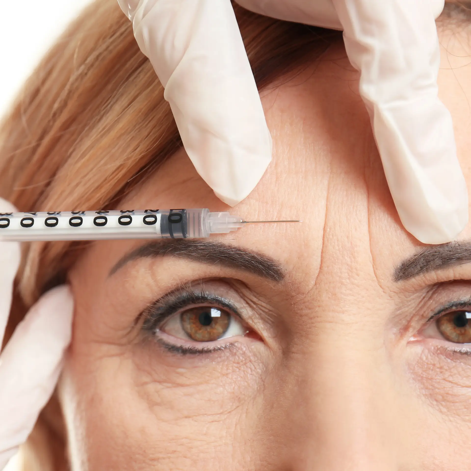 Botox vs Dysport consultation with Dr. Kat Khorrami, MD, at Allurant Medical Spa in San Diego