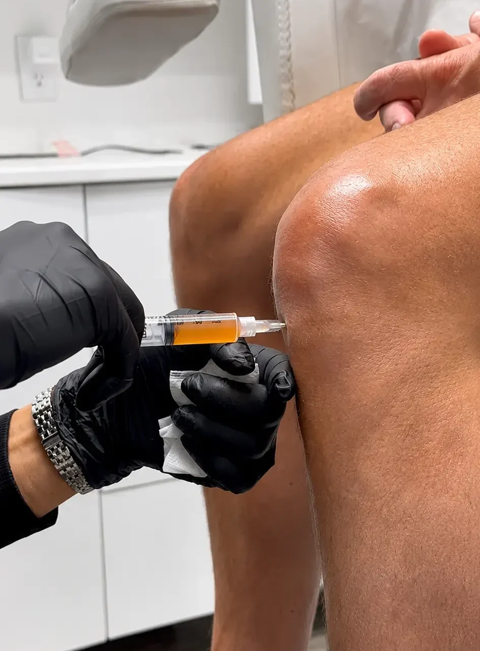 Patient receiving PRF therapy to support natural tissue regeneration and joint healing at Allurant Medical Spa in San Diego.