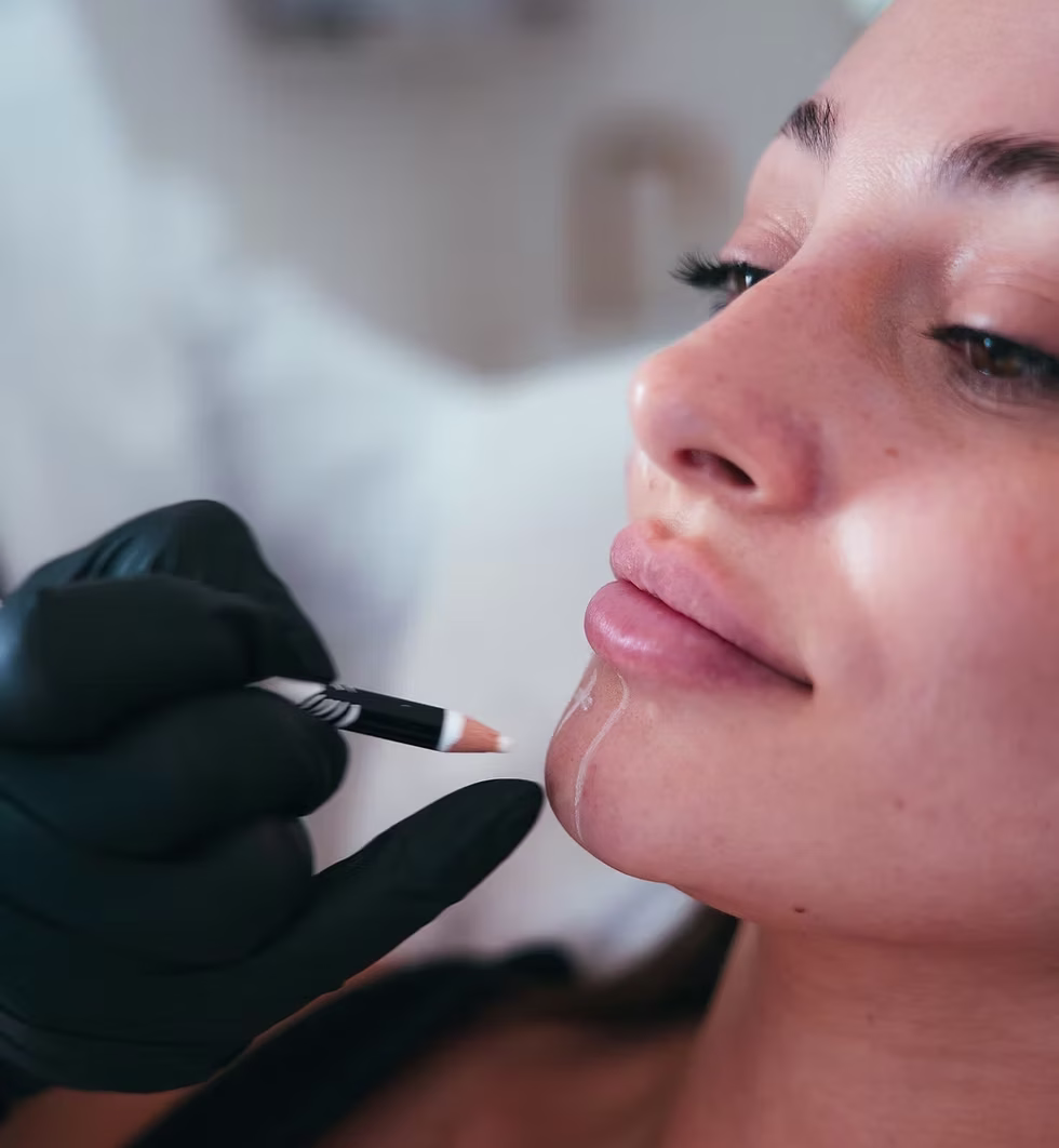 PDO thread lift chin San Diego jawline definition chin contouring Allurant Medical Spa