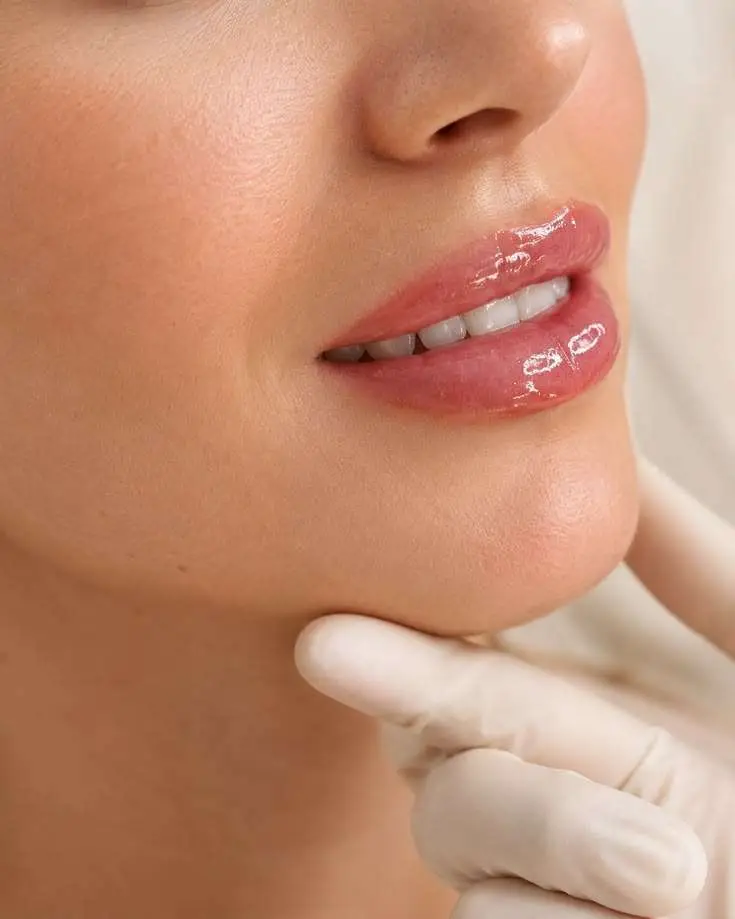 PRF lip treatment natural lip rejuvenation platelet rich fibrin lip collagen San Diego Allurant Medical Spa