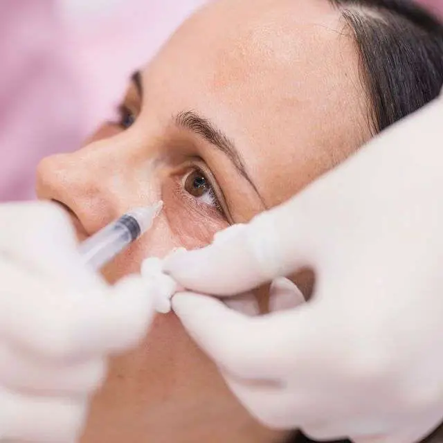 PRF under eye injection dark circles hollowness platelet rich fibrin treatment San Diego Allurant Medical Spa