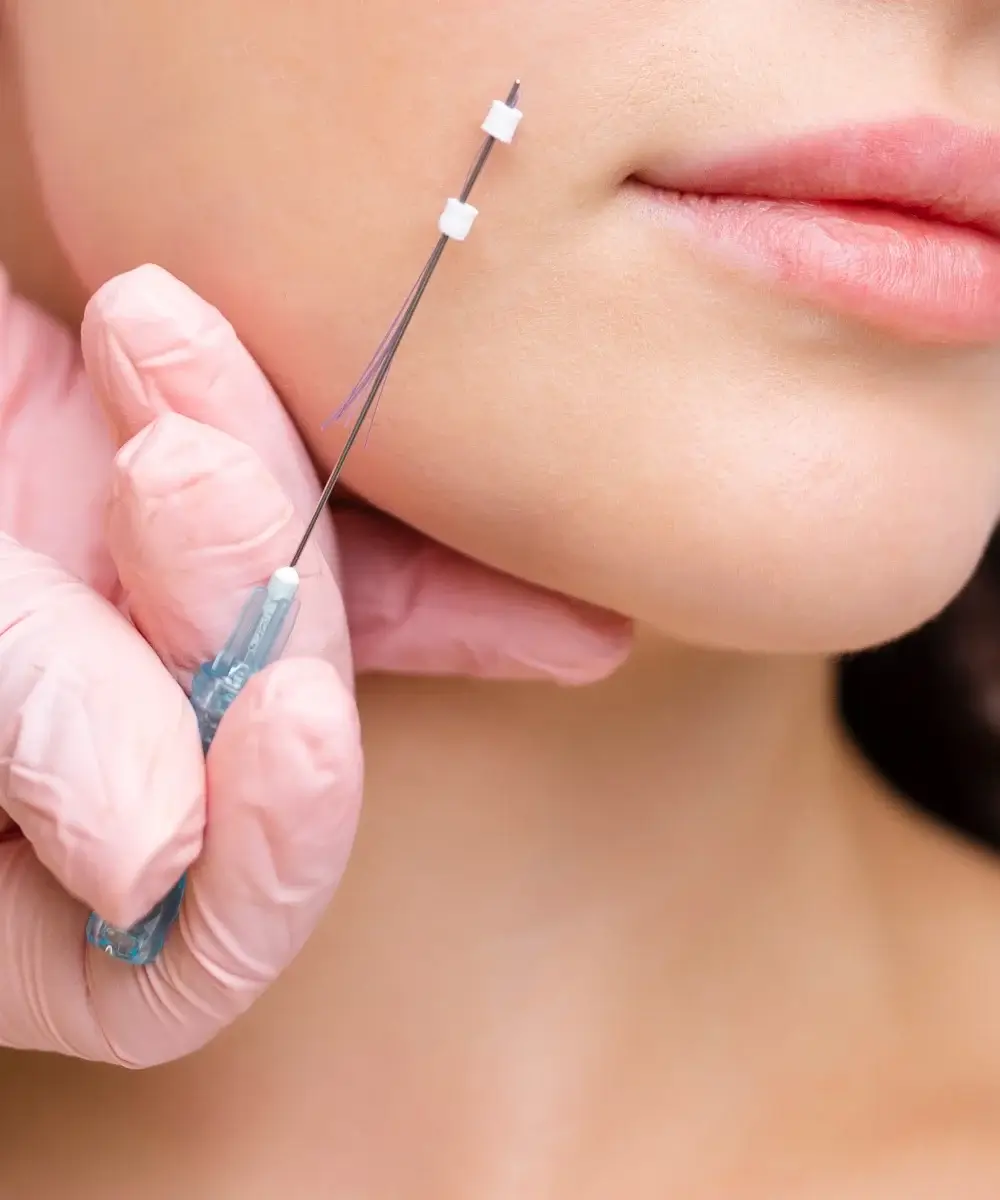 PDO threads San Diego non surgical facelift facial contouring jawline lift Allurant Medical Spa