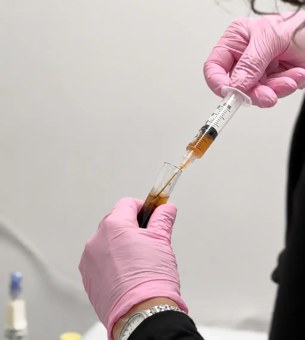 Preparing platelet rich fibrin for a PRF microneedling in San Diego