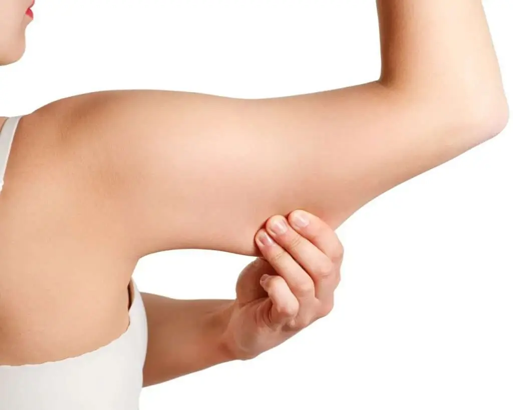 Non surgical arm fat reduction treatment options including EMSCULPT NEO and CoolSculpting for arms San Diego