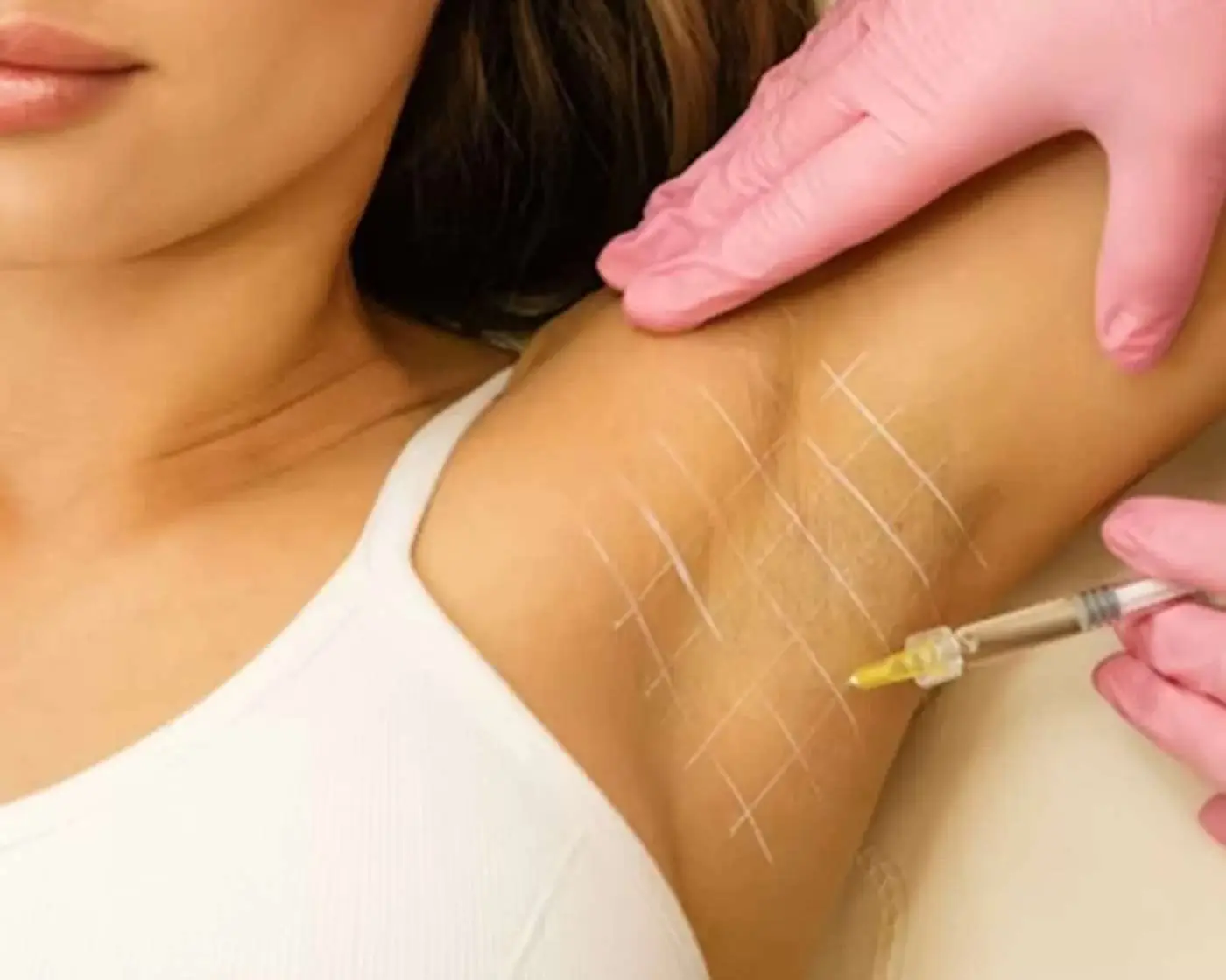 Patient receiving Botox treatment to address cosmetic and therapeutic concerns beyond wrinkle reduction.