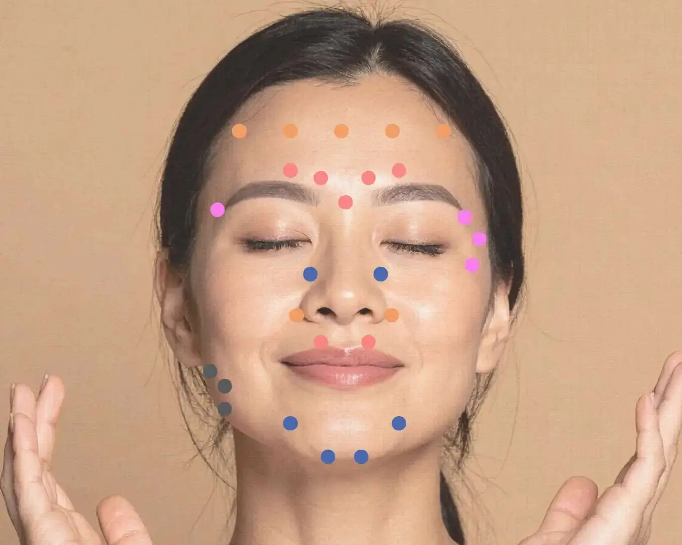 Illustration of common Botox treatment areas for facial wrinkle reduction