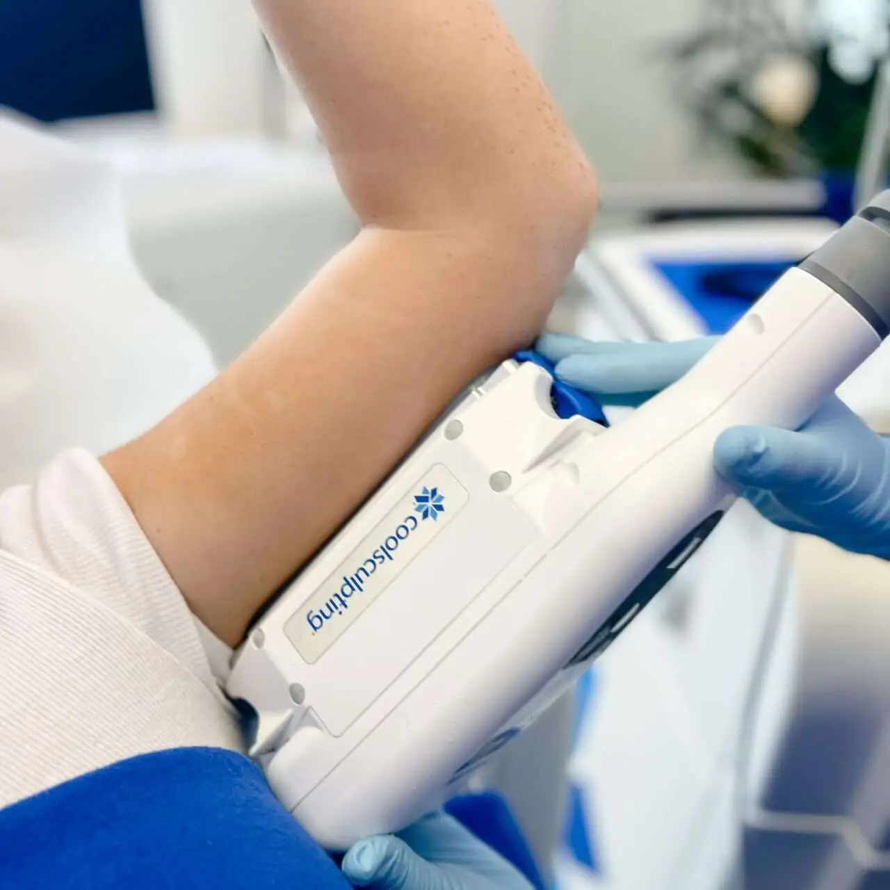 Patient comparing CoolSculpting and laser lipo arm fat treatment options at Allurant Medical Spa
