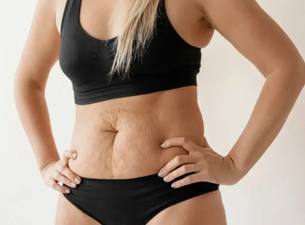 Woman checking postpartum abdominal muscle separation before diastasis recti treatment San Diego session