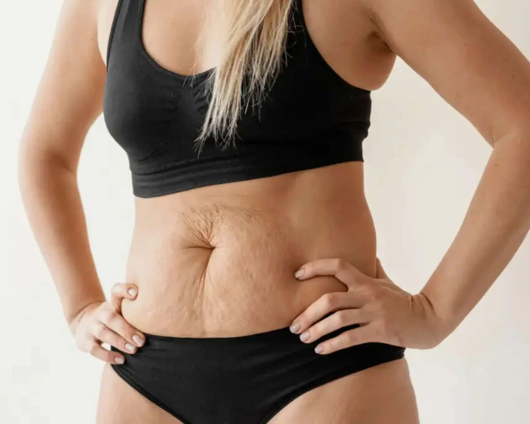 Diastasis recti treatment San Diego at Allurant Medical Spa in Carmel Valley