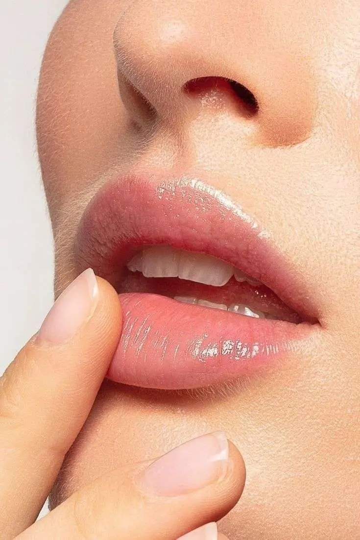 Fuller smoother defined lips after PRF lip treatment natural results Allurant Medical Spa San Diego