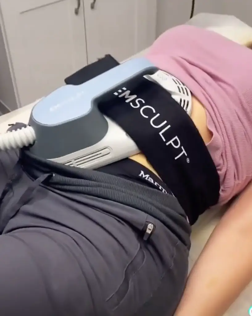 Allurant Medical Spa consultation room for body sculpting treatments in San Diego