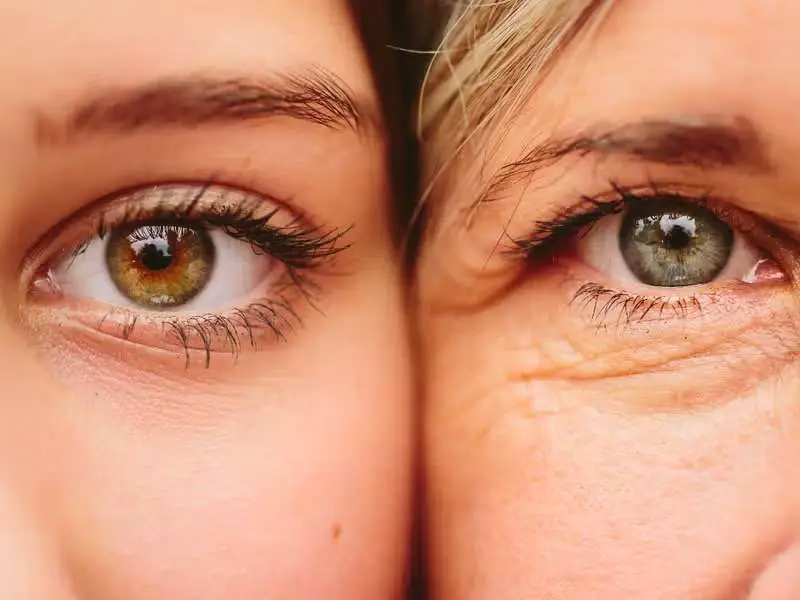 Allurant Medical Spa provider assessing dark circles under eyes in San Diego