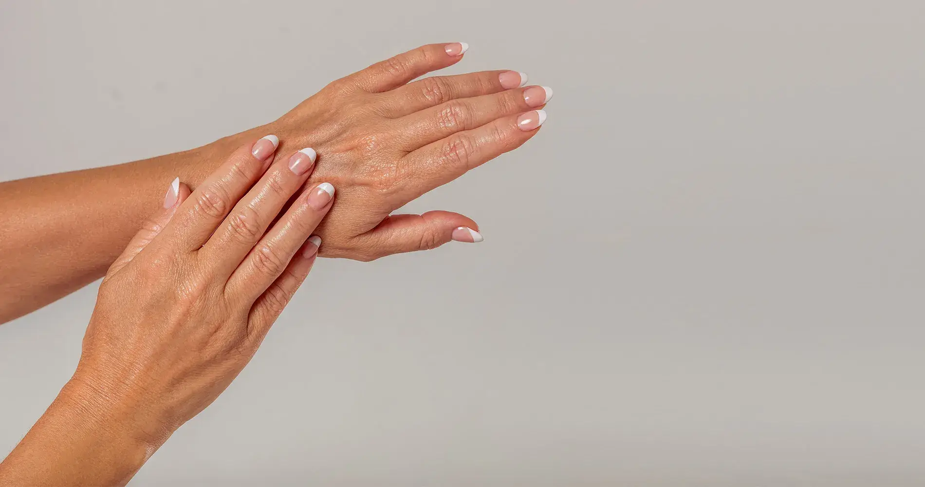 younger looking hands San Diego hand rejuvenation results age spots volume loss Allurant Medical Spa