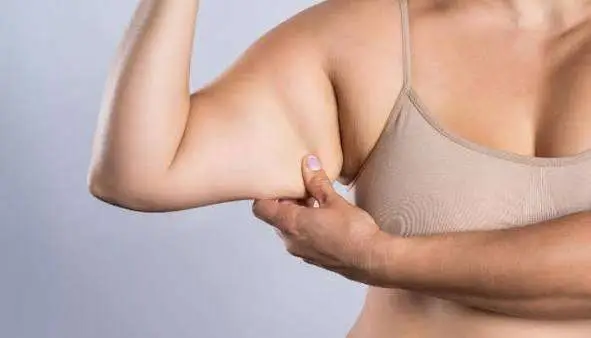 Woman with toned arms after non surgical skin tightening treatment in San Diego