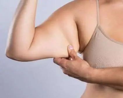 Loose skin on arms after weight loss treatment results at Allurant Medical Spa San Diego