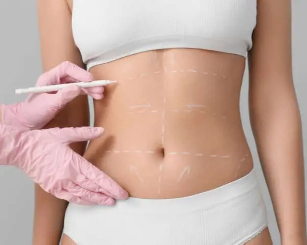 Medical weight loss vs body contouring San Diego guide