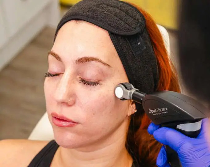 RF microneedling vs Opus Plasma comparison for under eye skin texture, Allurant Medical Spa San Diego