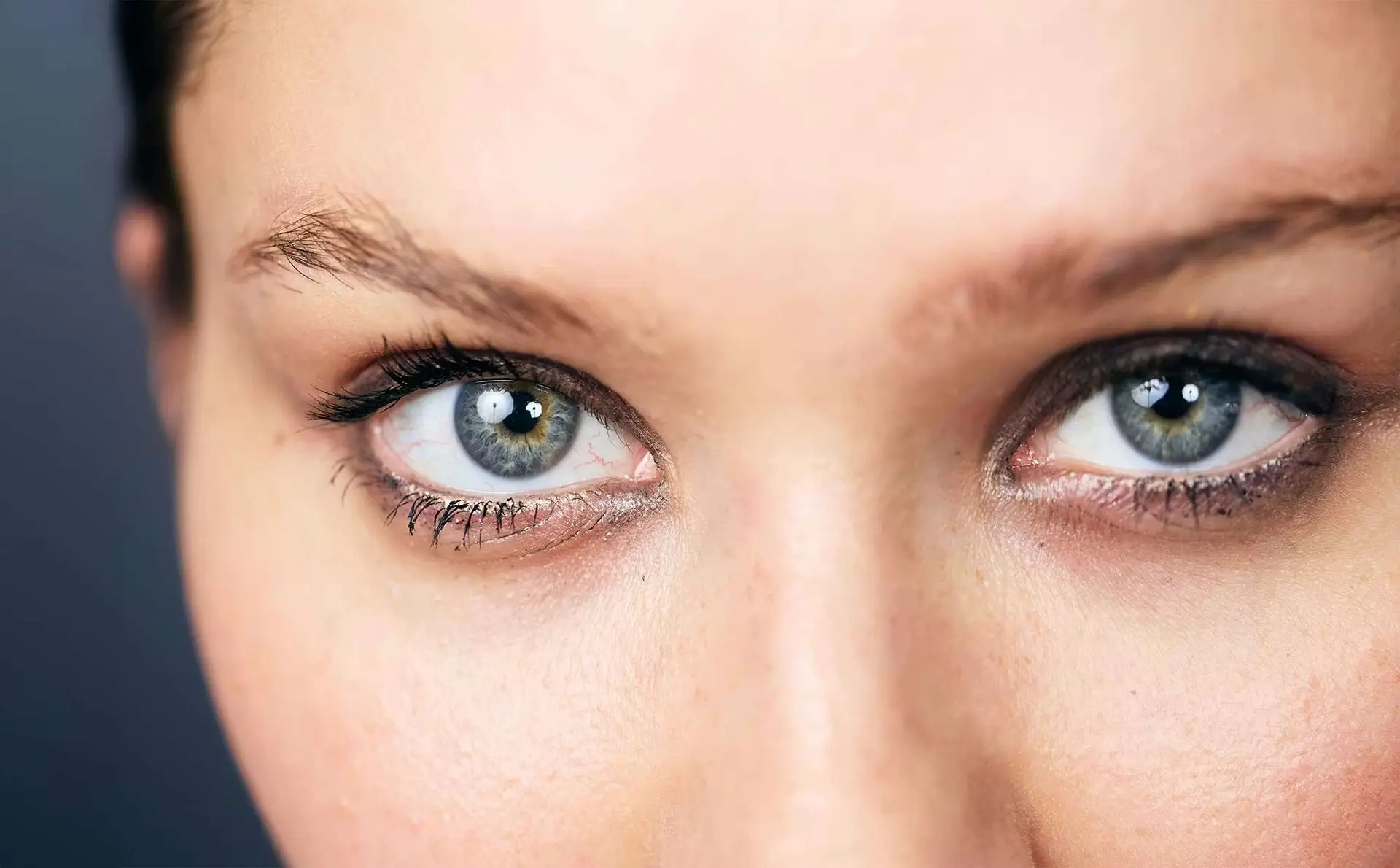 Patient consultation for under eye treatments in San Diego