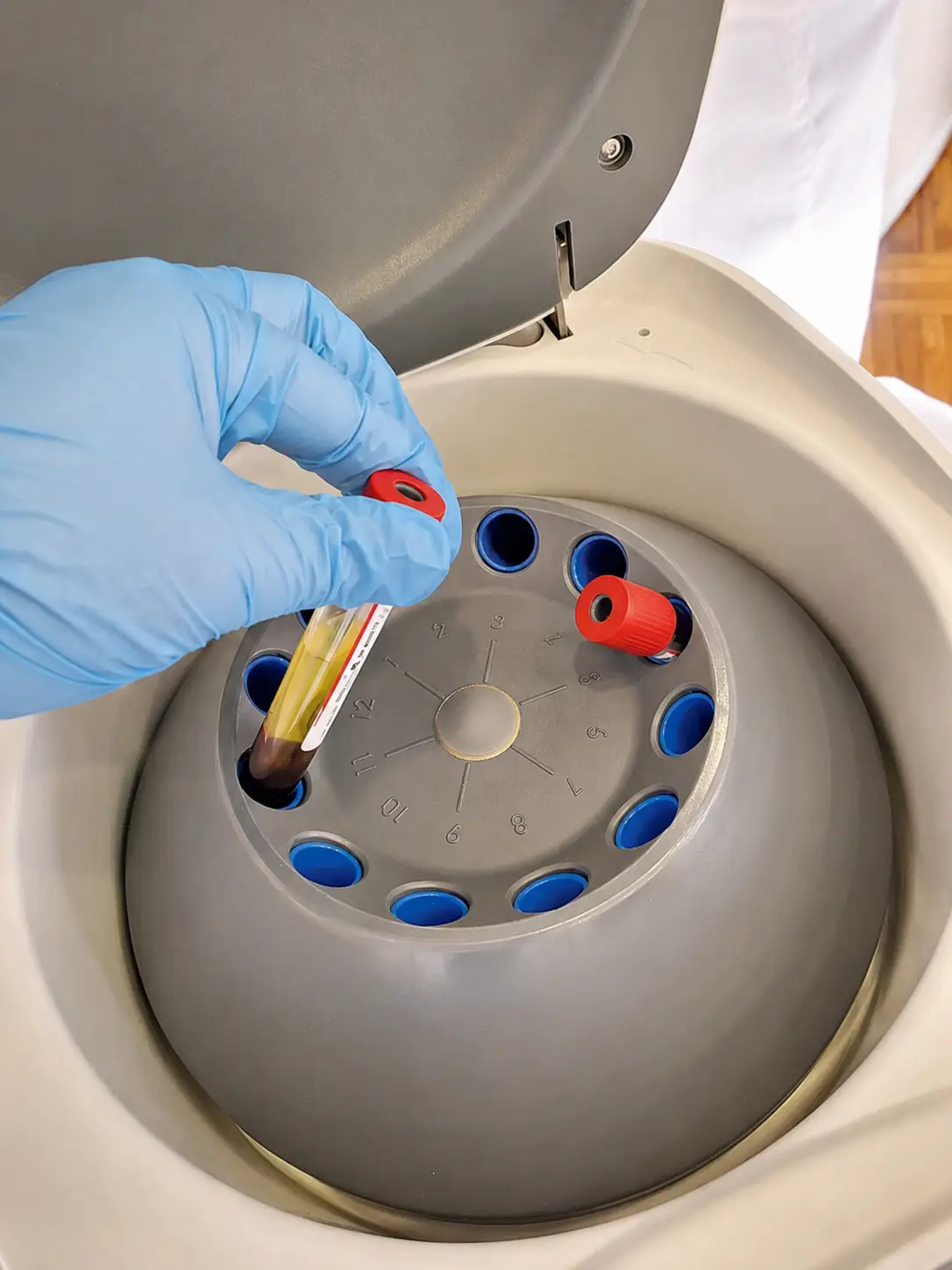 PRF preparation using a centrifuge for personalized under-eye treatment at Allurant Medical Spa in San Diego