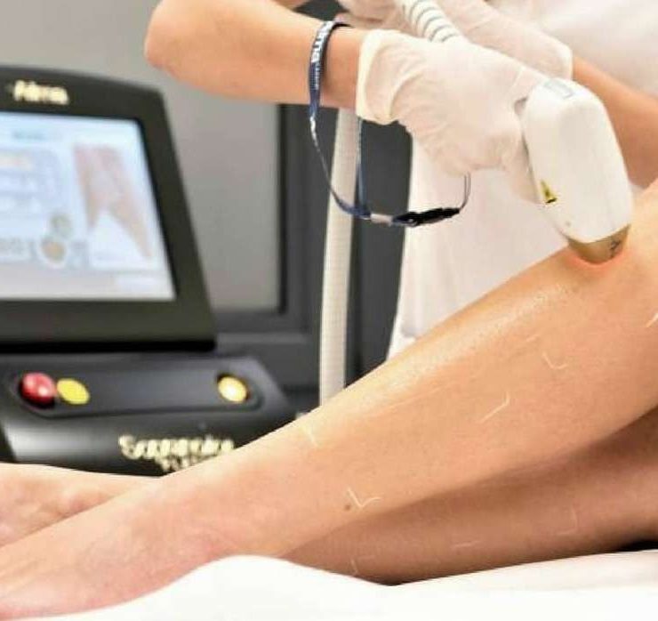 Laser Hair Removal - Large Area x8