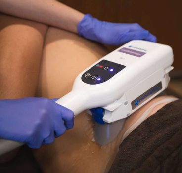 Coolsculpting-6-1536x1024-1.jpg